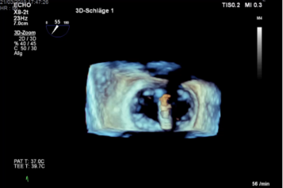 (c) Anna Bartunek (c) Anna Bartunek